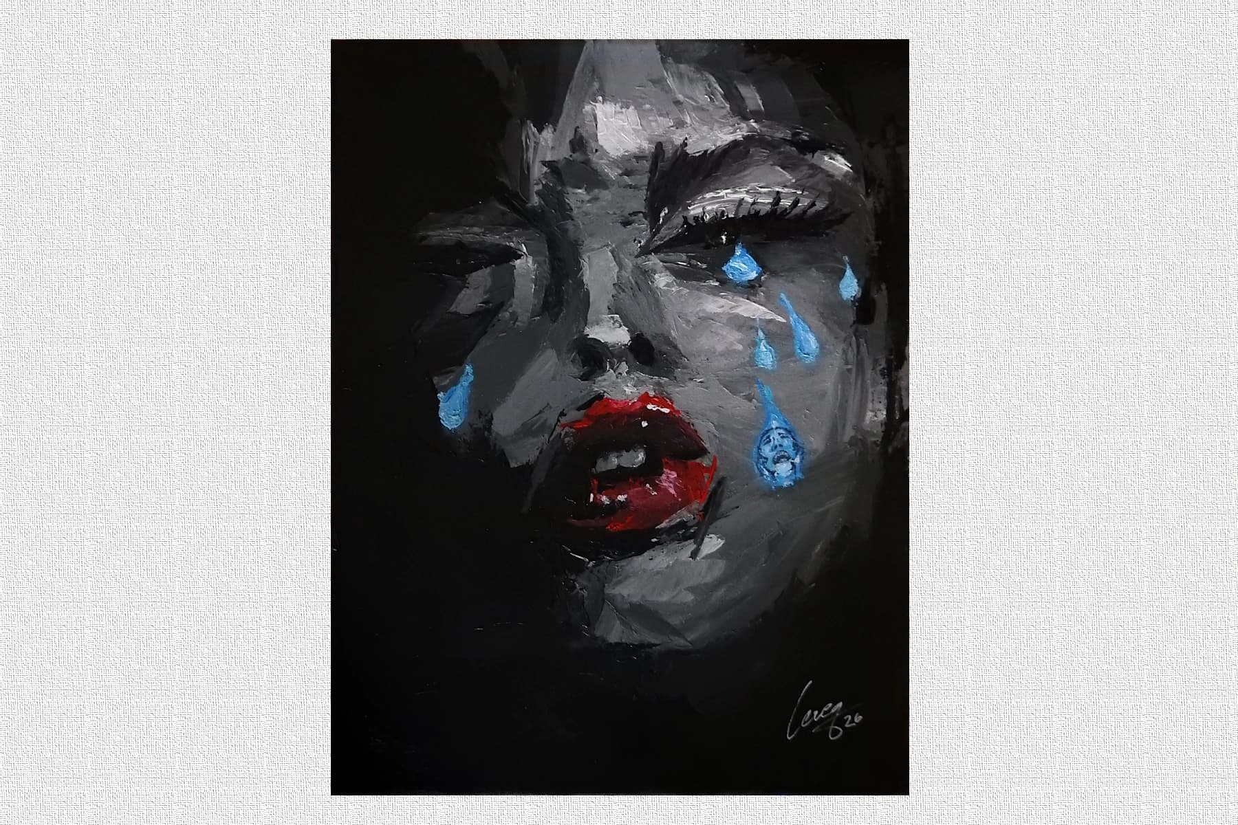 Douleur