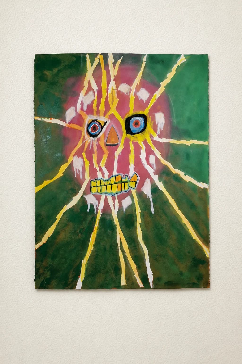 Psychosis