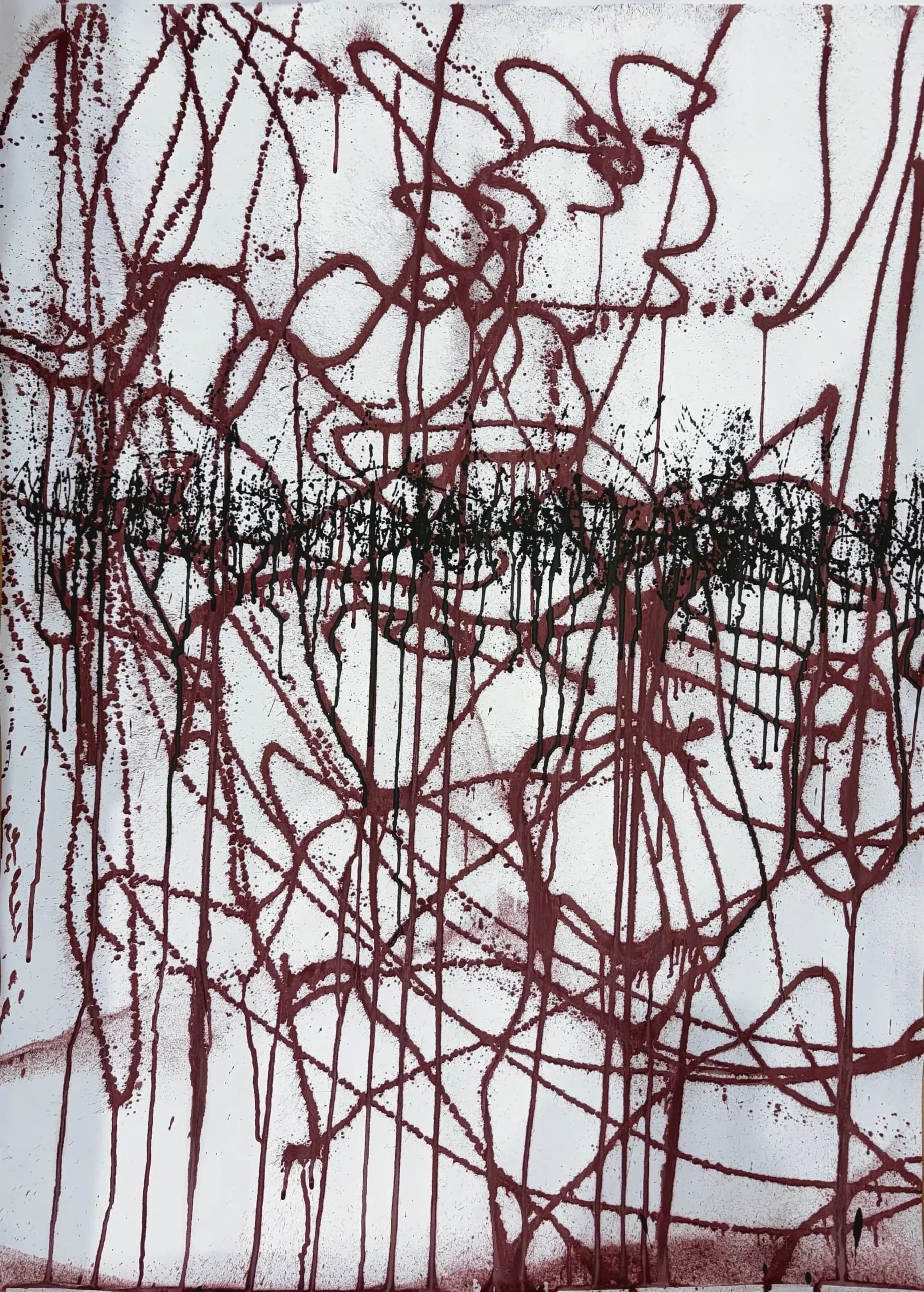 suture