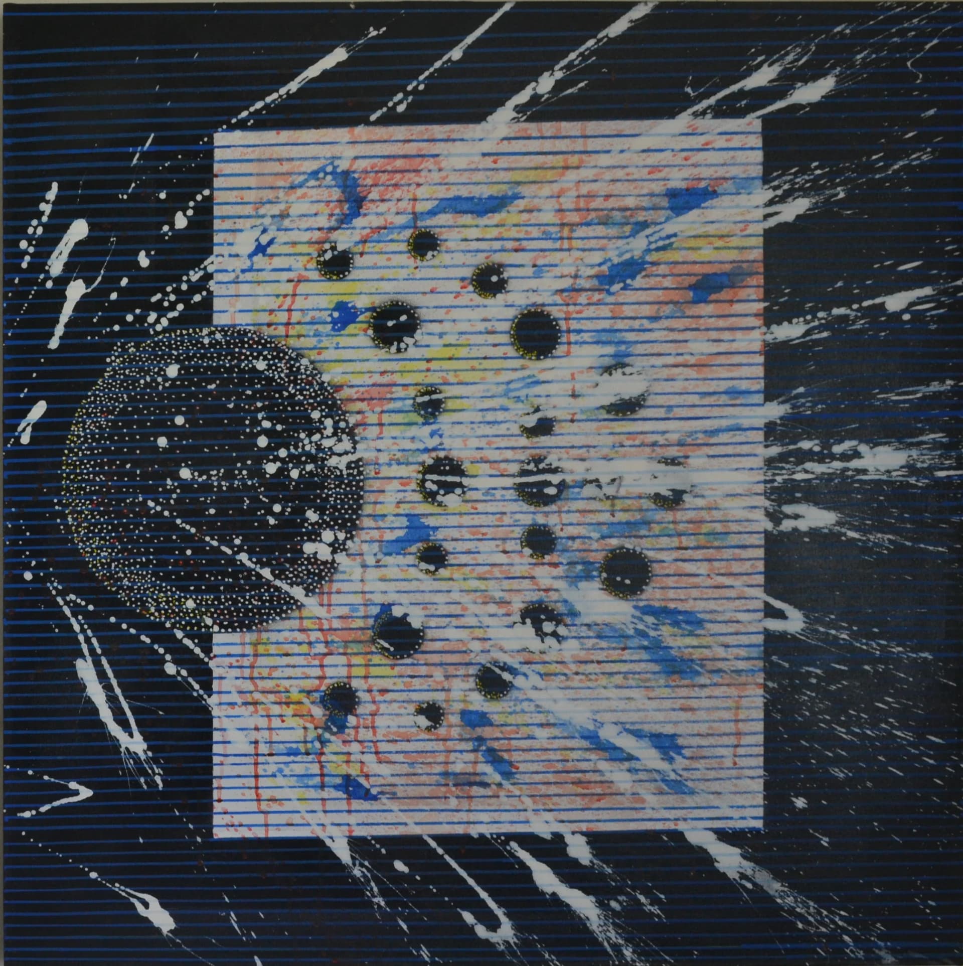 Artist-Vitrectomie