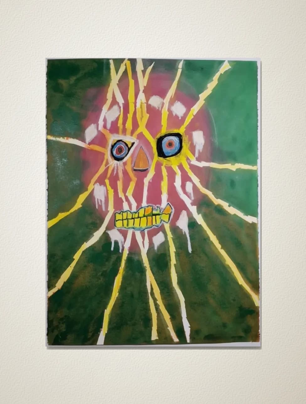 Psychosis